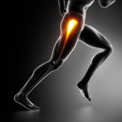 Iliotibial Band Syndrome — Fit For Life